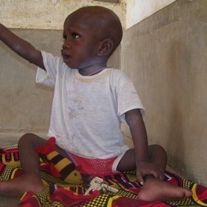 Image d'un enfant qui a retrouver la santé après 26jours d'alimentation à la spiruline